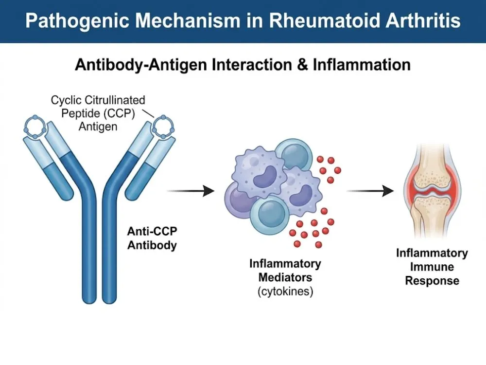 A scientific diagram showing a Y-shaped antibody binding to a cyclic citrullinated peptide antigen, triggering an inflammatory immune response.